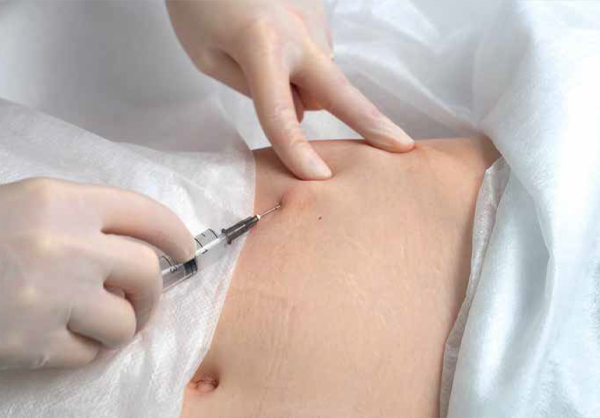 Процесс коррекции