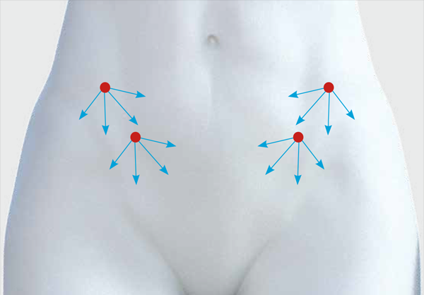 Состояние до коррекции