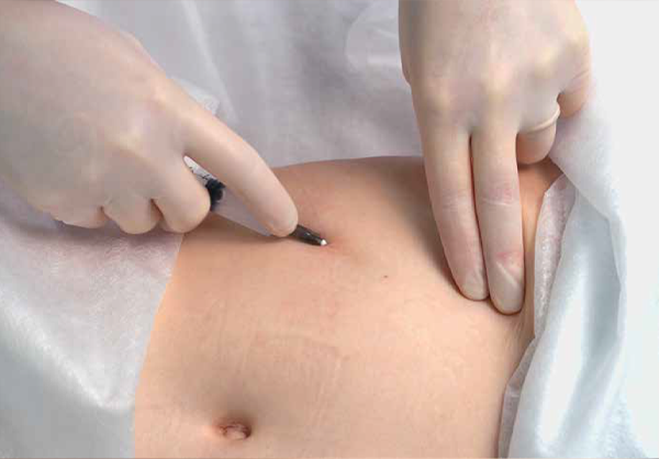 Процесс коррекции