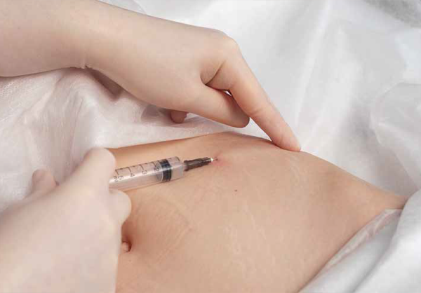 Процесс коррекции